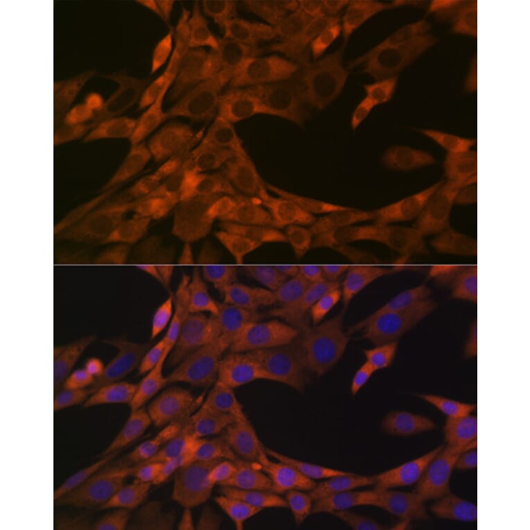 Immunofluorescence - Anti-HE4 Antibody [ARC1936] (A305524) - Antibodies.com