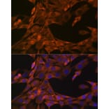 Immunofluorescence - Anti-HE4 Antibody [ARC1936] (A305524) - Antibodies.com