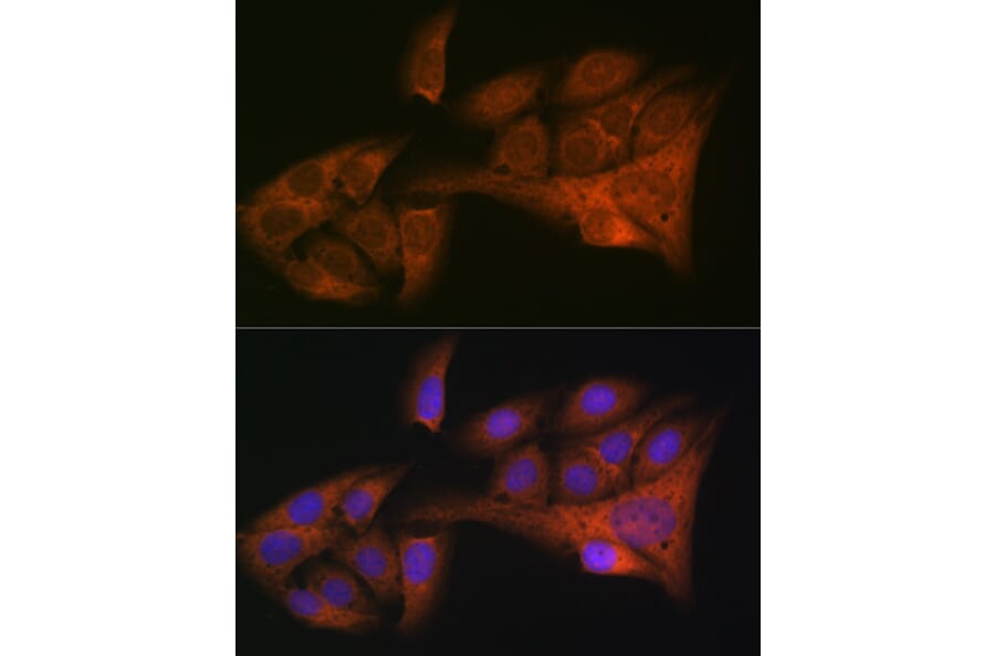 Immunofluorescence - Anti-HE4 Antibody [ARC1936] (A305524) - Antibodies.com
