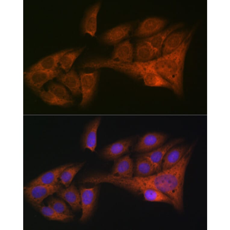 Immunofluorescence - Anti-HE4 Antibody [ARC1936] (A305524) - Antibodies.com