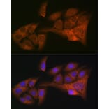 Immunofluorescence - Anti-HE4 Antibody [ARC1936] (A305524) - Antibodies.com