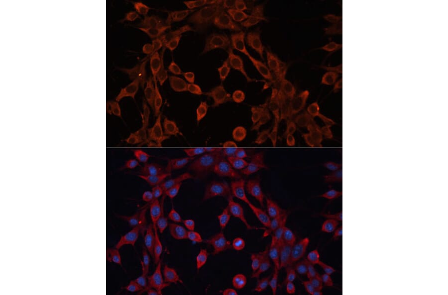Immunofluorescence - Anti-ABCA12 Antibody (A305525) - Antibodies.com