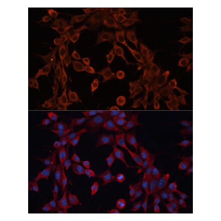 Immunofluorescence - Anti-ABCA12 Antibody (A305525) - Antibodies.com