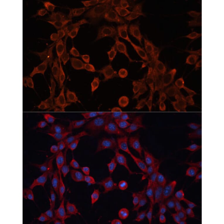 Immunofluorescence - Anti-ABCA12 Antibody (A305525) - Antibodies.com