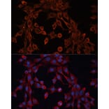 Immunofluorescence - Anti-ABCA12 Antibody (A305525) - Antibodies.com