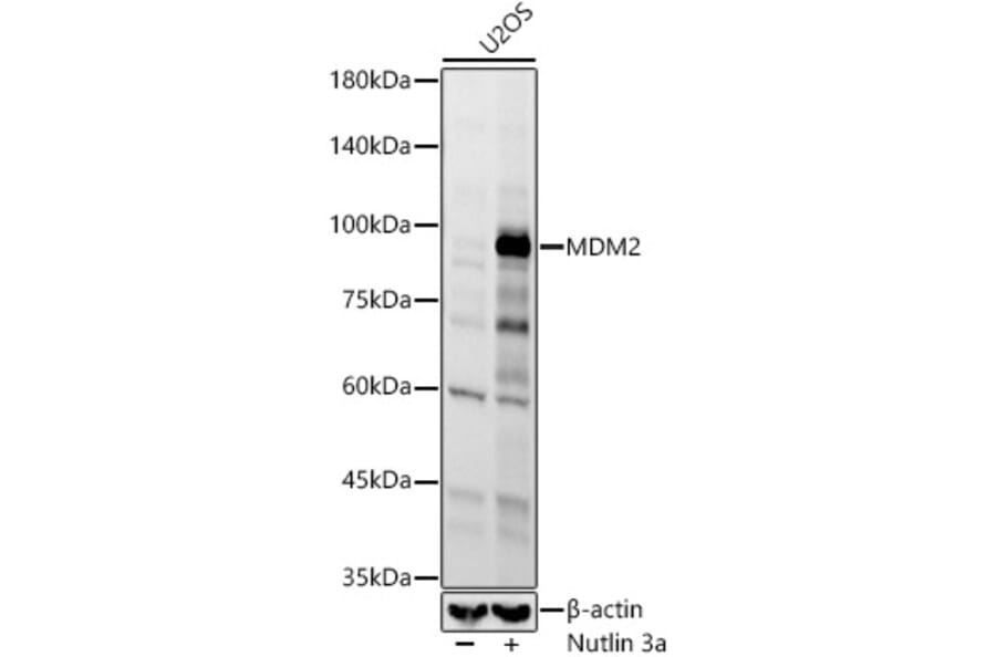 Western Blot - Anti-MDM2 Antibody [ARC60296] (A305526) - Antibodies.com