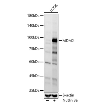 Western Blot - Anti-MDM2 Antibody [ARC60296] (A305526) - Antibodies.com