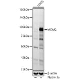 Western Blot - Anti-MDM2 Antibody [ARC60296] (A305526) - Antibodies.com