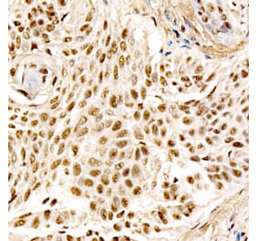 Immunohistochemistry - Anti-MDM2 Antibody (A305527) - Antibodies.com