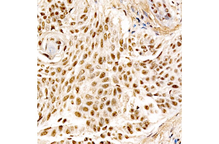Immunohistochemistry - Anti-MDM2 Antibody [ARC60294] (A305527) - Antibodies.com
