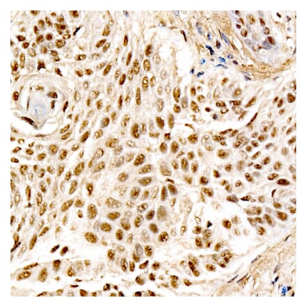 Immunohistochemistry - Anti-MDM2 Antibody [ARC60294] (A305527) - Antibodies.com