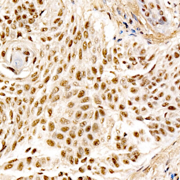 Immunohistochemistry - Anti-MDM2 Antibody [ARC60294] (A305527) - Antibodies.com