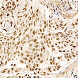 Immunohistochemistry - Anti-MDM2 Antibody [ARC60294] (A305527) - Antibodies.com