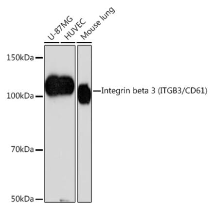 Western Blot - Anti-Integrin beta 3 Antibody [ARC0460] (A305528) - Antibodies.com