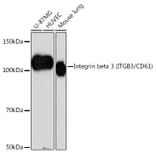 Western Blot - Anti-Integrin beta 3 Antibody [ARC0460] (A305528) - Antibodies.com