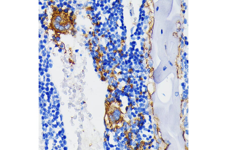 Immunohistochemistry - Anti-Integrin beta 3 Antibody [ARC0460] (A305528) - Antibodies.com