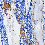 Immunohistochemistry - Anti-Integrin beta 3 Antibody [ARC0460] (A305528) - Antibodies.com