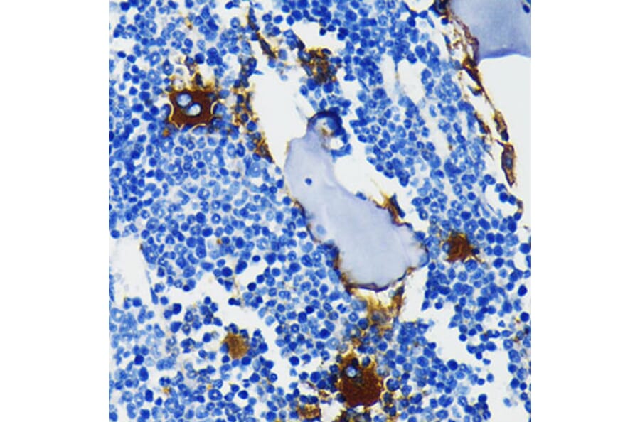 Immunohistochemistry - Anti-Integrin beta 3 Antibody [ARC0460] (A305528) - Antibodies.com