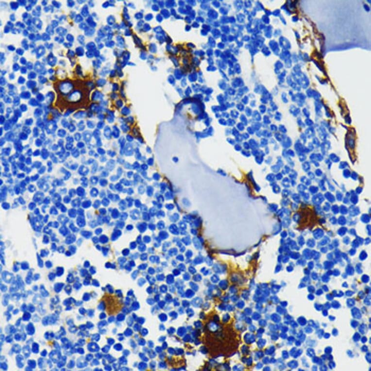 Immunohistochemistry - Anti-Integrin beta 3 Antibody [ARC0460] (A305528) - Antibodies.com