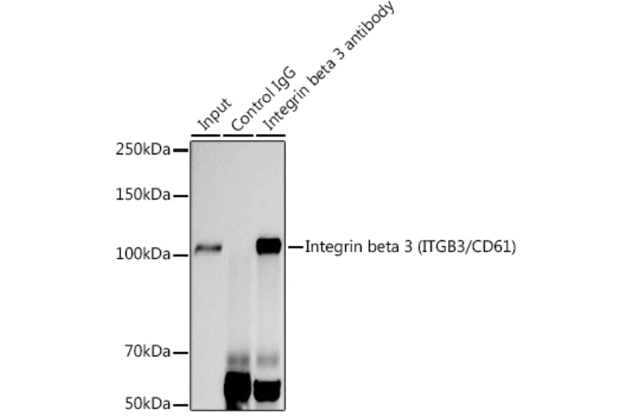 Western Blot - Anti-Integrin beta 3 Antibody [ARC0460] (A305528) - Antibodies.com