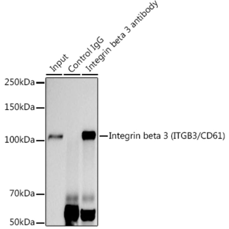 Western Blot - Anti-Integrin beta 3 Antibody [ARC0460] (A305528) - Antibodies.com