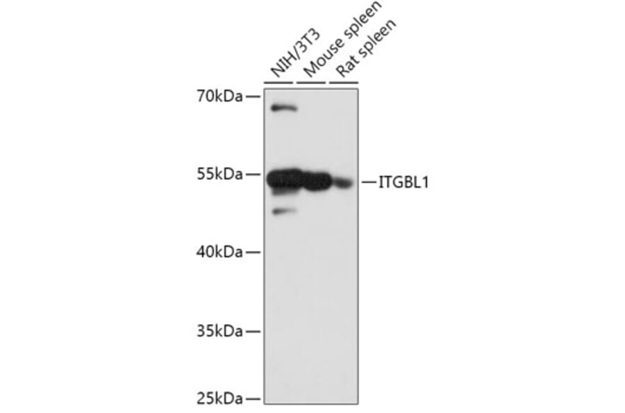 Western Blot - Anti-OSCP Antibody (A305529) - Antibodies.com