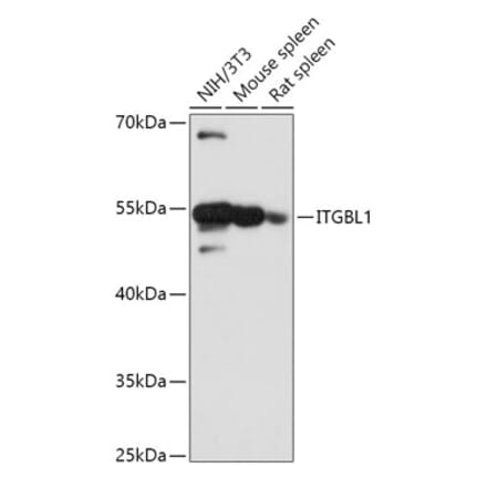 Western Blot - Anti-OSCP Antibody (A305529) - Antibodies.com