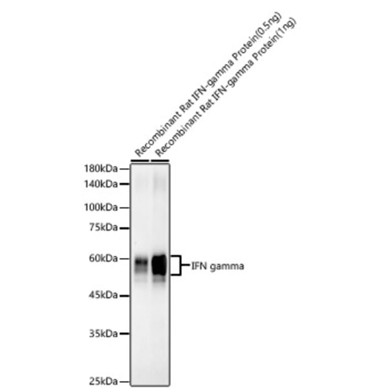 Western Blot - Anti-Interferon gamma Antibody [ARC57549] (A305530) - Antibodies.com