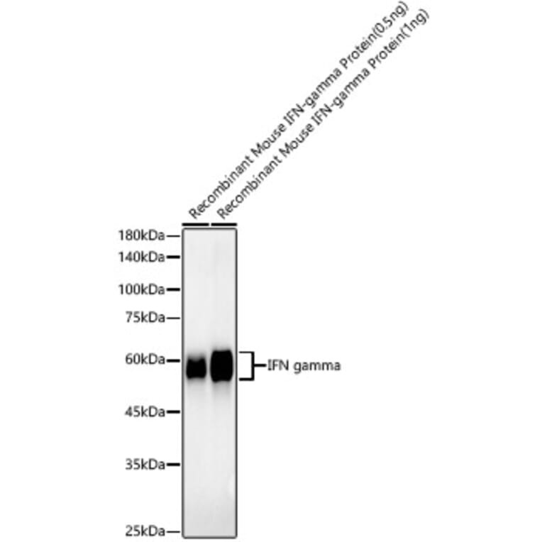 Western Blot - Anti-Interferon gamma Antibody [ARC57549] (A305530) - Antibodies.com