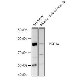 Western Blot - Anti-PGC1 alpha Antibody (A305531) - Antibodies.com