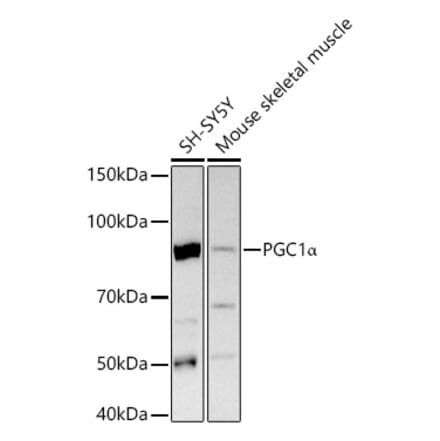 Western Blot - Anti-PGC1 alpha Antibody (A305531) - Antibodies.com