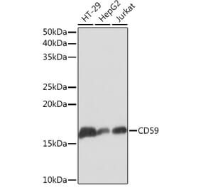 Western Blot - Anti-CD59 Antibody [ARC0896] (A305532) - Antibodies.com