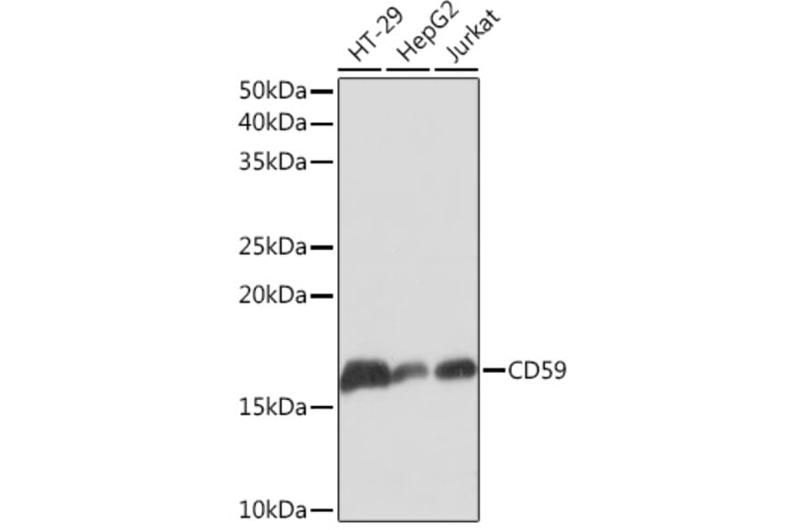 Western Blot - Anti-CD59 Antibody [ARC0896] (A305532) - Antibodies.com