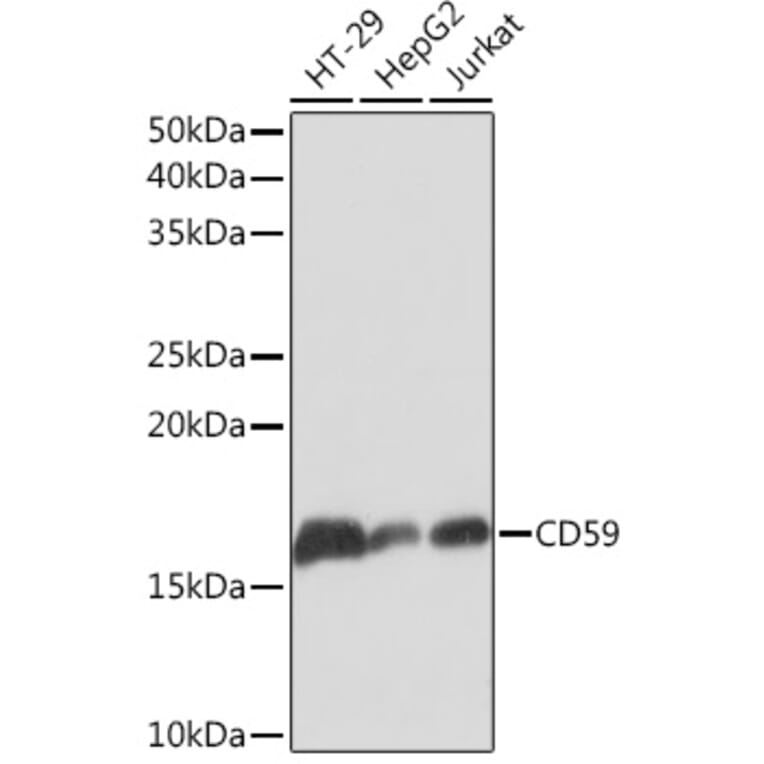 Western Blot - Anti-CD59 Antibody [ARC0896] (A305532) - Antibodies.com