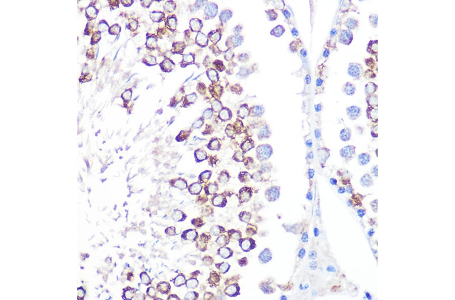 Immunohistochemistry - Anti-CD59 Antibody [ARC0896] (A305532) - Antibodies.com