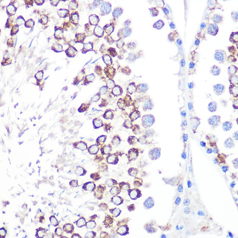 Immunohistochemistry - Anti-CD59 Antibody [ARC0896] (A305532) - Antibodies.com