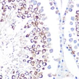 Immunohistochemistry - Anti-CD59 Antibody [ARC0896] (A305532) - Antibodies.com