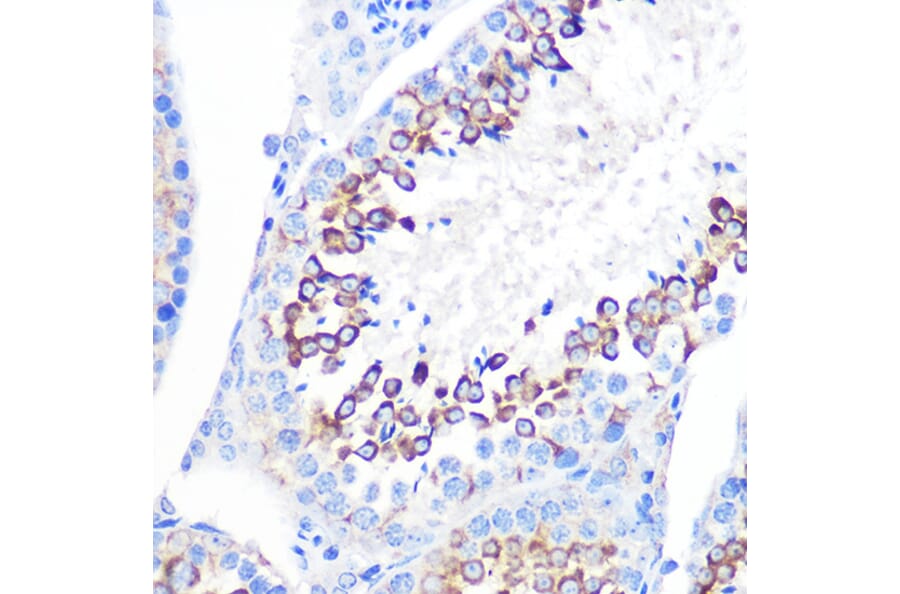 Immunohistochemistry - Anti-CD59 Antibody [ARC0896] (A305532) - Antibodies.com