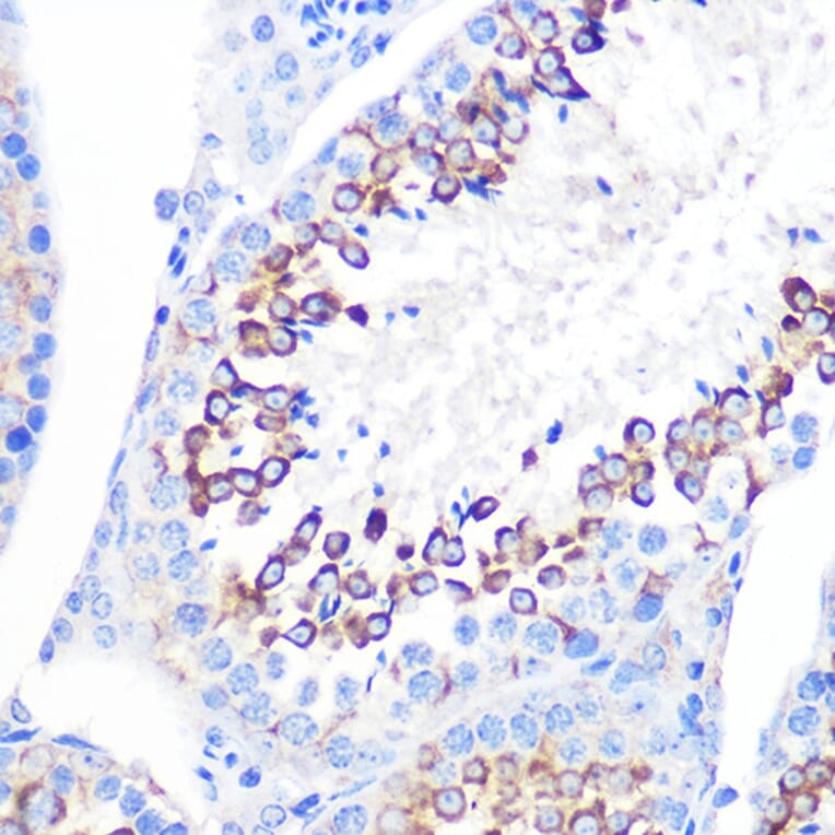 Immunohistochemistry - Anti-CD59 Antibody [ARC0896] (A305532) - Antibodies.com