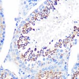 Immunohistochemistry - Anti-CD59 Antibody [ARC0896] (A305532) - Antibodies.com