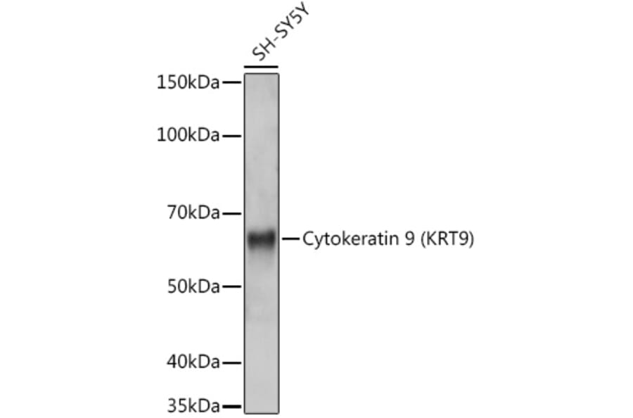 Western Blot - Anti-Cytokeratin 9 Antibody [ARC1664] (A305533) - Antibodies.com