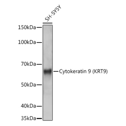 Western Blot - Anti-Cytokeratin 9 Antibody [ARC1664] (A305533) - Antibodies.com