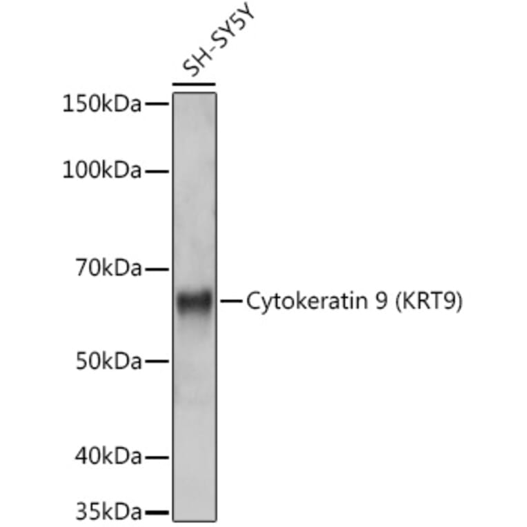 Western Blot - Anti-Cytokeratin 9 Antibody [ARC1664] (A305533) - Antibodies.com