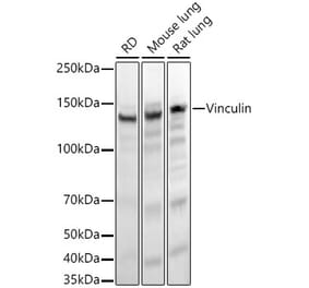 Western Blot - Anti-Vinculin Antibody [ARC51900] (A305534) - Antibodies.com