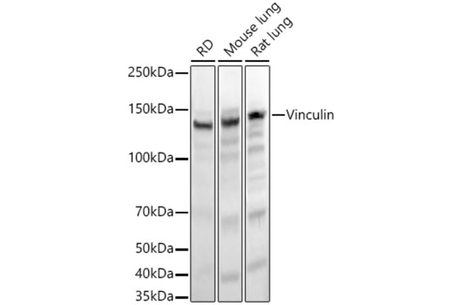 Western Blot - Anti-Vinculin Antibody [ARC51900] (A305534) - Antibodies.com