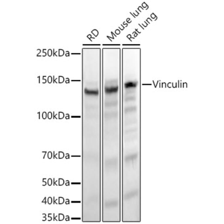 Western Blot - Anti-Vinculin Antibody [ARC51900] (A305534) - Antibodies.com