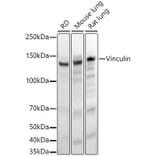 Western Blot - Anti-Vinculin Antibody [ARC51900] (A305534) - Antibodies.com