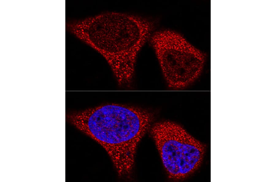 Immunofluorescence - Anti-Vinculin Antibody [ARC51900] (A305534) - Antibodies.com
