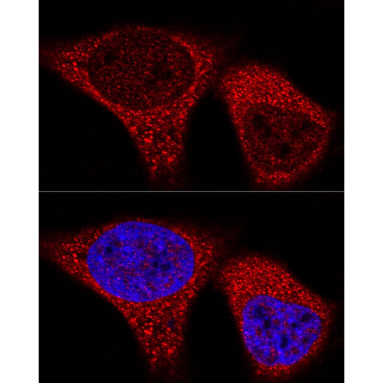 Immunofluorescence - Anti-Vinculin Antibody [ARC51900] (A305534) - Antibodies.com