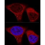 Immunofluorescence - Anti-Vinculin Antibody [ARC51900] (A305534) - Antibodies.com